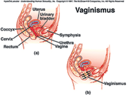 Bloody virginity loss