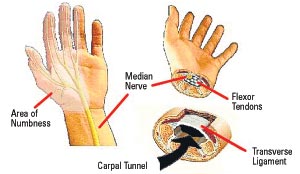 What are the most serious neuropathy symptoms?