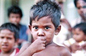 Malnutrition not only a poor man’s disease