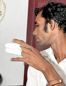 Ranga Dumnida shows his injuries