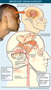 Brain-Graphic