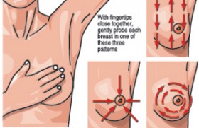 Spotting the clues for cancer