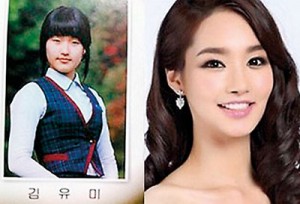 Before and after:22-year-old Yu-Mi Kim