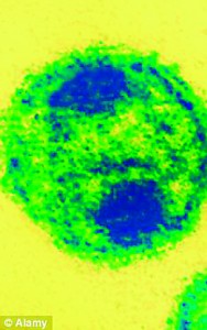 HIV 'cure' may be possible 2