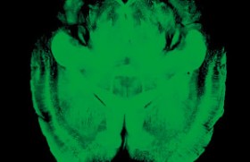 See-through brains promise to clear up mental mysteries