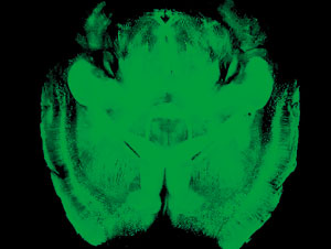 A CLARITY scan of an entire intact mouse brain is seen in this undated handout image (Reuters)