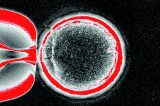 Scientists create human stem cells through cloning