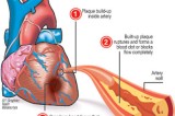7 things you should know about heart attacks