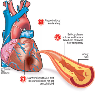 How can you tell if you are having a heart attack?