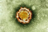 Saudi announces new death from SARS-like virus