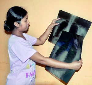 Samanthika shows her x rays