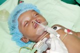 Cleft lip and palate repair surgery unit in Vavuniya, a relief to poor parents