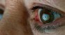 Google’s next crazy project: Smart contact lenses