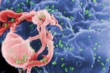 Scientists ‘delete’ HIV virus from human DNA