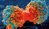 Most cancer types ‘just bad luck’