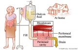 The all-important filtering organ in our body