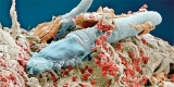 These microscopic mites live on your face