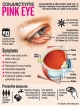 Conjunctivitis cases higher than last year