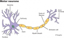 Learning to live with Motor Neurone Disease