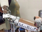 Robotic Prosthetic Arm developed by University of Moratuwa to help war victims