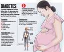 Don’t let diabetes strike you during pregnancy