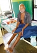 SUROL a friend in need and deed to Leprosy-affected people
