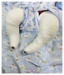 From clubfoot to normal feet