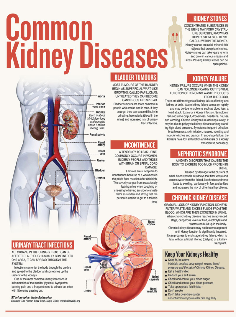 Common Kidney Diseases | Times Online - Daily Online Edition of The