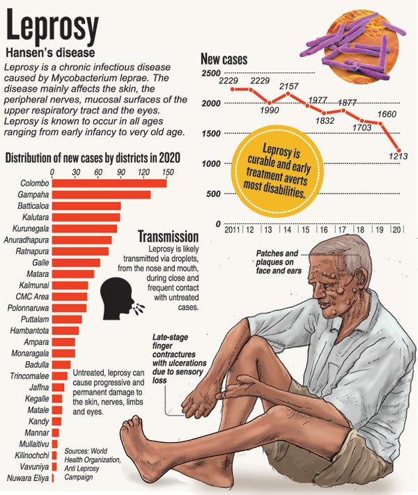Leprosy cases on the rise during pandemic; eradication deadline revised