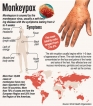 ‘Monkeypox nowhere as dangerous as novel coronavirus’