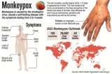 No reason to panic, says Health Ministry as first case of monkeypox detected in SL