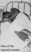 One of the injured inmaters
