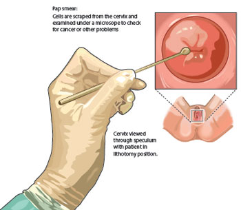 Vagina Swollen After Sex