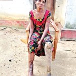 Jeevaratnam Manjula: Lost her leg in  a battle at Palaly