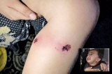 UN flags torture, physical abuse of children by Israel