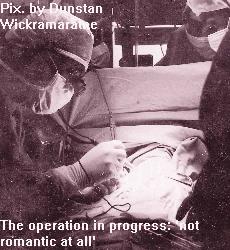 Operation
