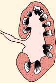 A kidney