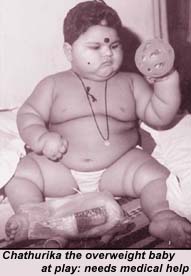 Chathurika the overweight baby at play: needs medical help
