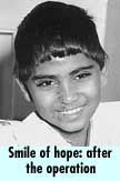 Smile of hope: after the operation